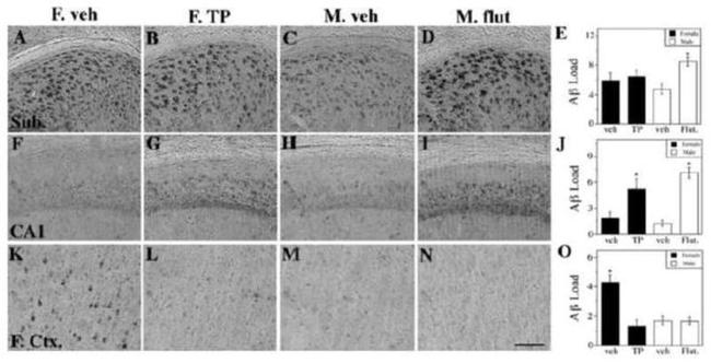 beta Amyloid Antibody in Immunohistochemistry (IHC)