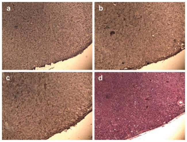 CD51 (Integrin alpha V) Antibody in Immunohistochemistry (IHC)