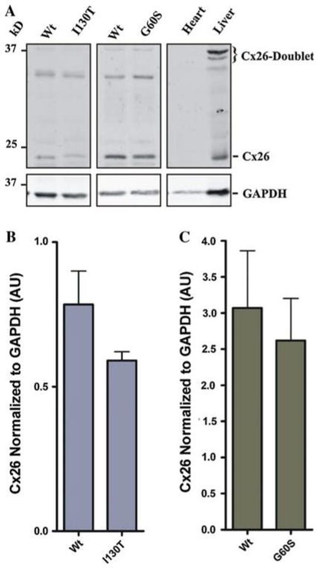 Connexin 26 Antibody in Western Blot (WB)