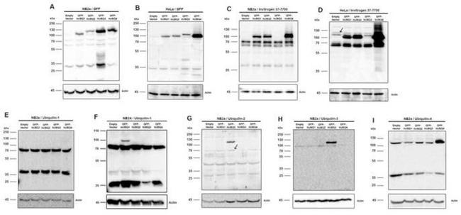 Ubiquilin 1 Antibody in Western Blot (WB)