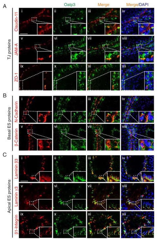 beta Catenin Antibody in Immunohistochemistry (IHC)