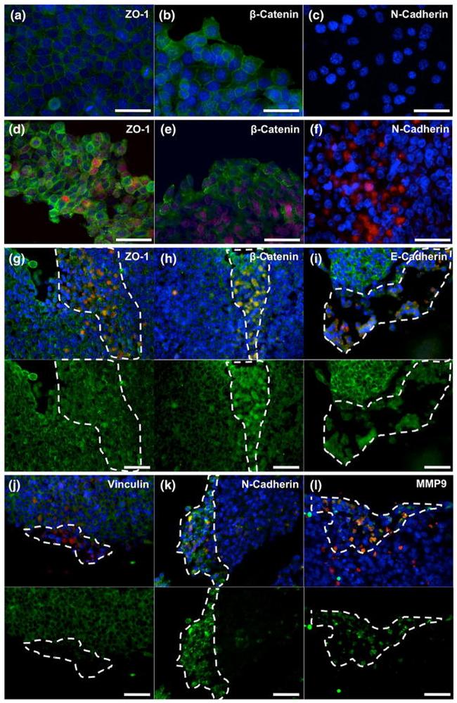 beta Catenin Antibody in Immunocytochemistry (ICC/IF)