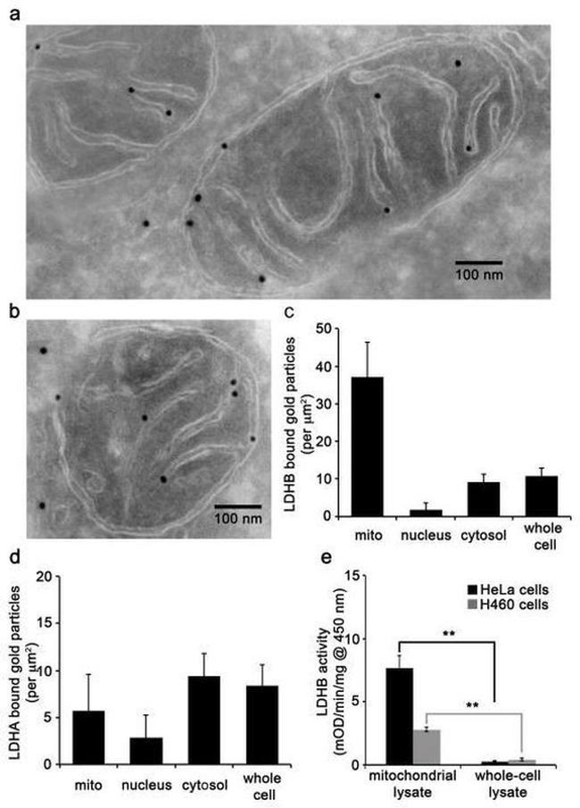 LDHA Antibody in Immunomicroscopy (IM)