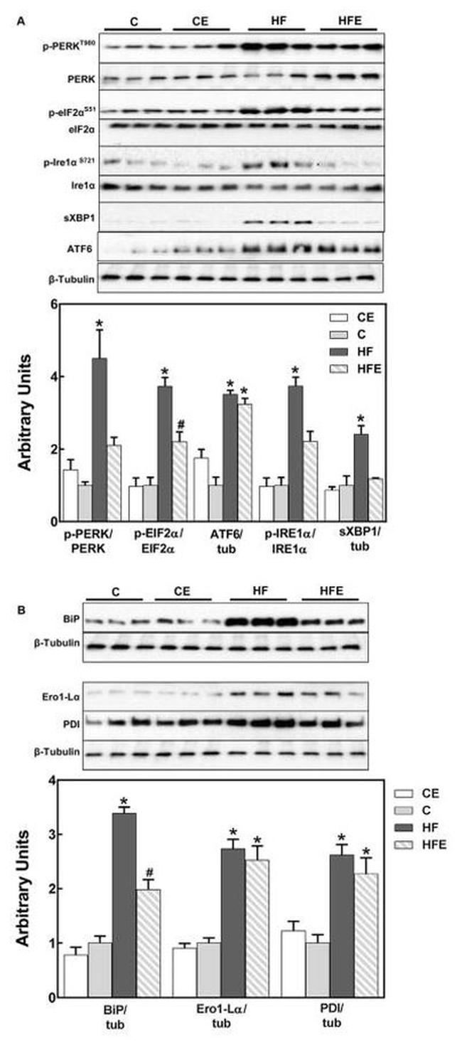 Phospho-IRE1 alpha (Ser724) Antibody in Western Blot (WB)