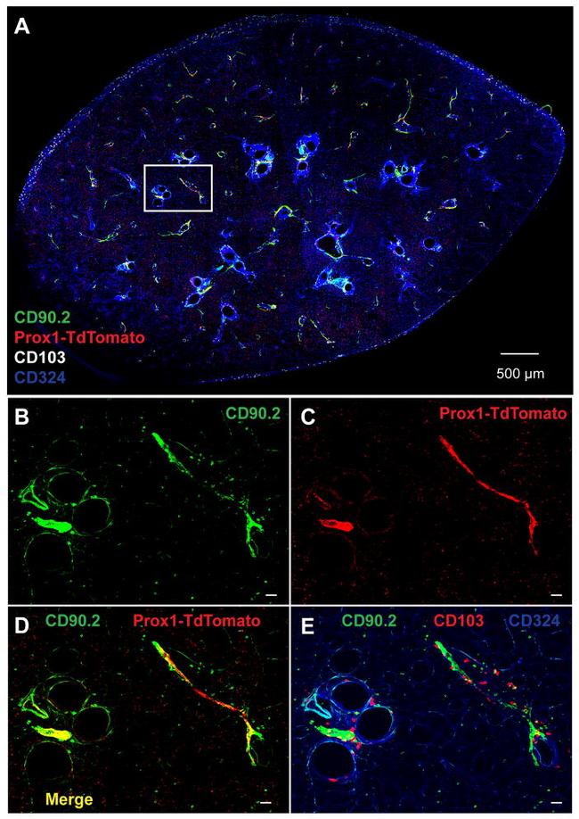 CD324 (E-Cadherin) Antibody in Immunohistochemistry (IHC)