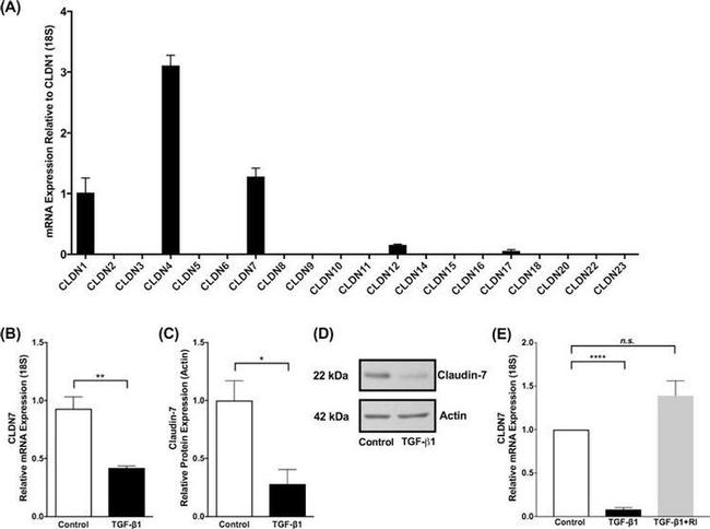 Claudin 7 Antibody in Western Blot (WB)