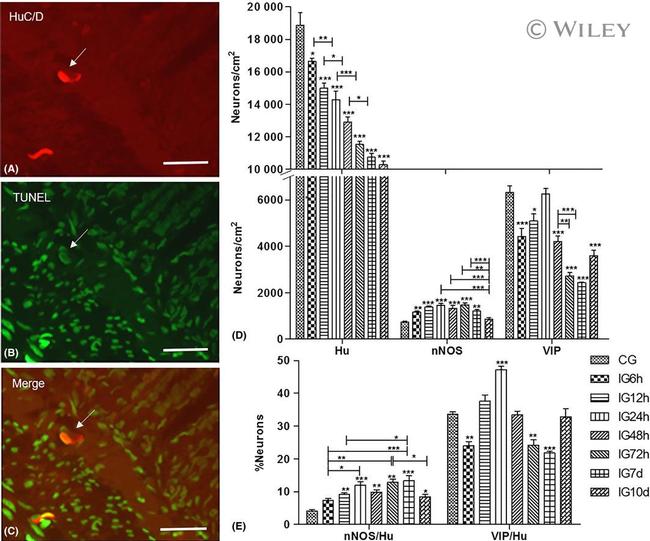 nNOS Antibody in Immunohistochemistry (IHC)