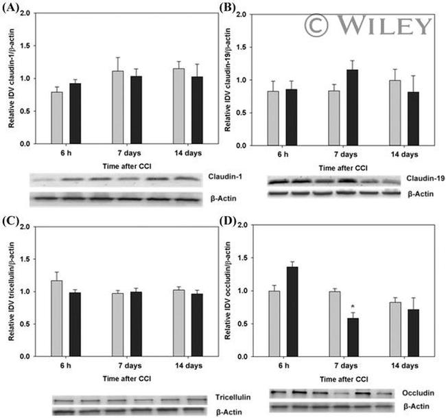 MARVELD2 Antibody in Western Blot (WB)