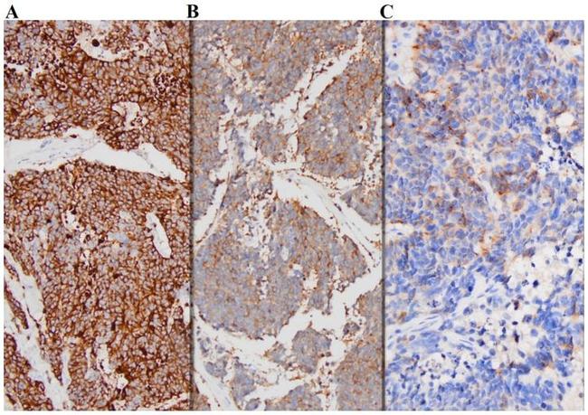 Chromogranin A Antibody in Immunohistochemistry (IHC)