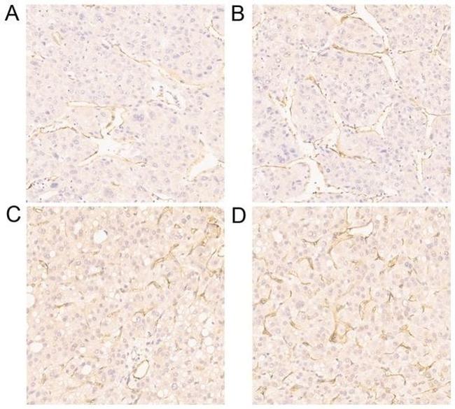 CD34 Antibody in Immunohistochemistry (IHC)