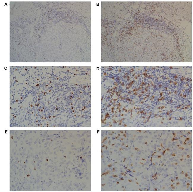 CD8 alpha Antibody in Immunohistochemistry (IHC)