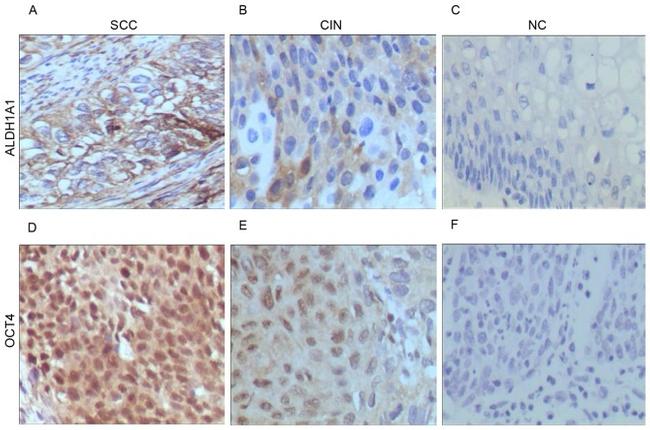 OCT4 Antibody in Immunohistochemistry (Paraffin) (IHC (P))