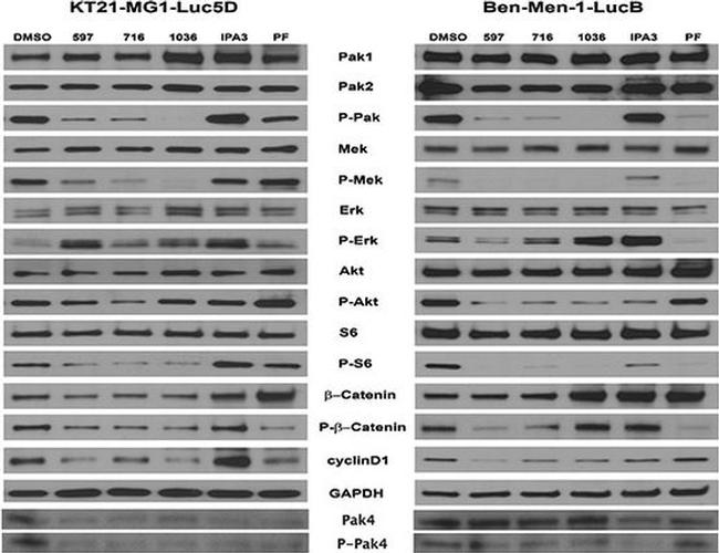 Phospho-PAK1/2/3 (Ser141) Antibody in Western Blot (WB)