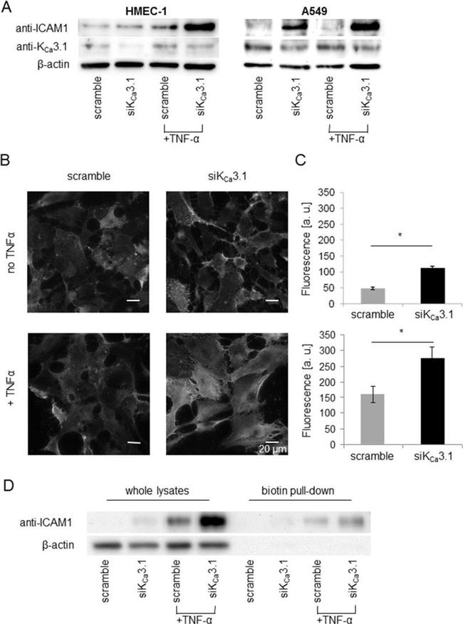 ICAM-1 Antibody in Western Blot (WB)