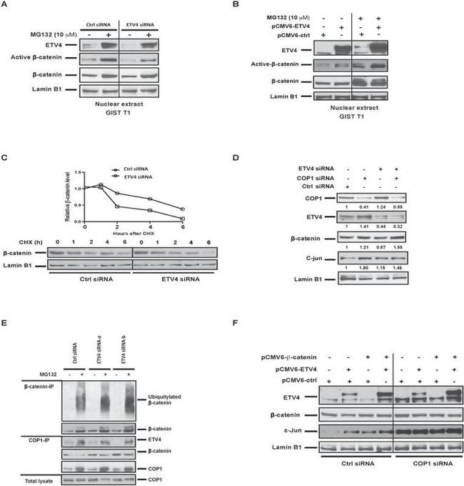 Lamin B1 Antibody in Western Blot (WB)