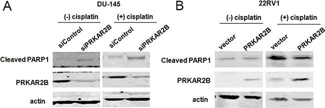 PRKAR2B Antibody in Western Blot (WB)