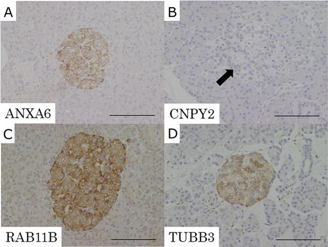 RAB11B Antibody in Immunohistochemistry (IHC)