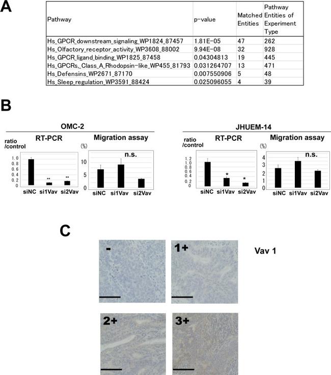 VAV1 Antibody in Immunohistochemistry (Paraffin) (IHC (P))