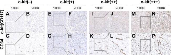 CD34 Antibody in Immunohistochemistry (IHC)