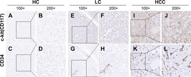 CD34 Antibody in Immunohistochemistry (IHC)