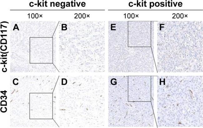 CD34 Antibody in Immunohistochemistry (IHC)