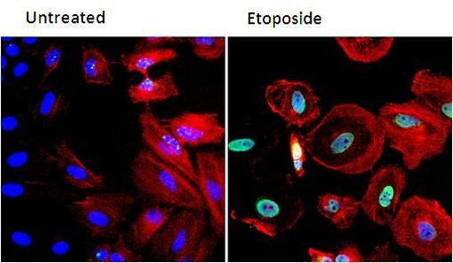 Phospho-ATM (Ser1981) Antibody in Immunocytochemistry (ICC/IF)