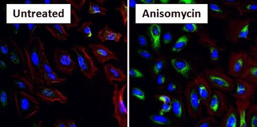 Phospho-HSP27 (Ser15) Antibody in Immunocytochemistry (ICC/IF)