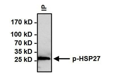 Phospho-HSP27 (Ser15) Antibody in Immunoprecipitation (IP)