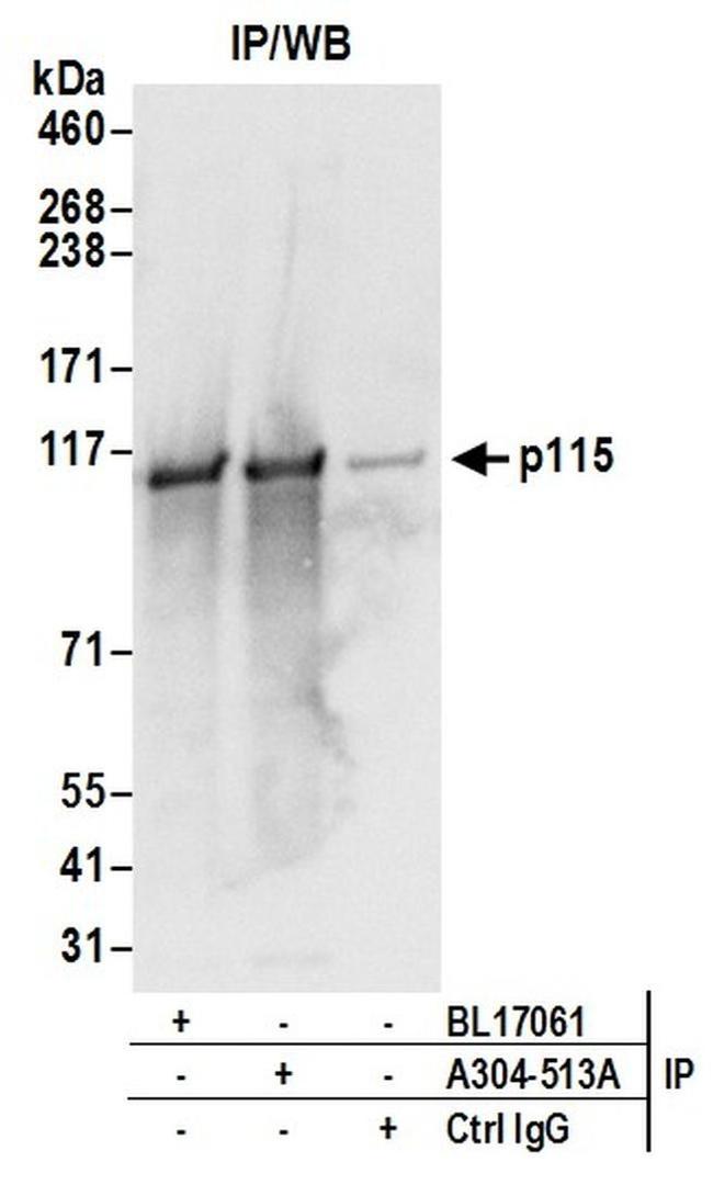 p115 Antibody in Western Blot (WB)