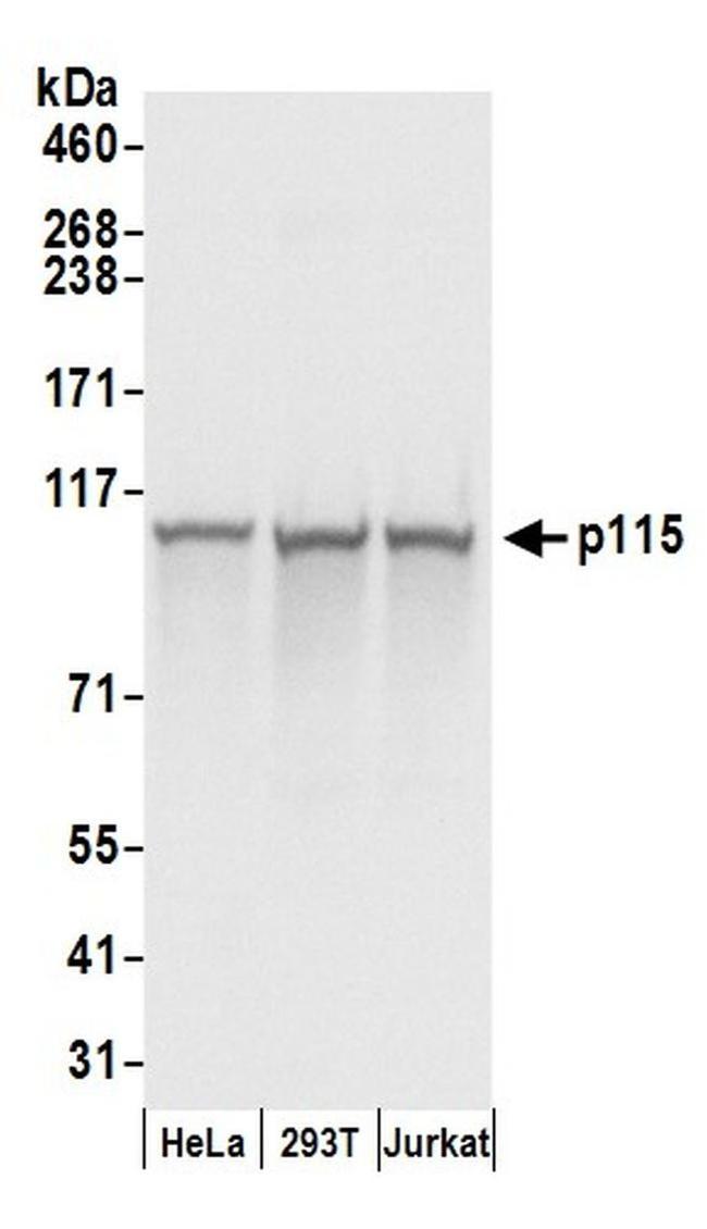 p115 Antibody in Western Blot (WB)