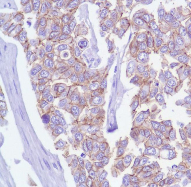 delta Catenin Antibody in Immunohistochemistry (Paraffin) (IHC (P))