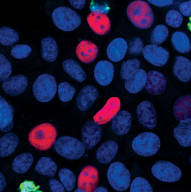 p21 Antibody in Immunocytochemistry (ICC/IF)