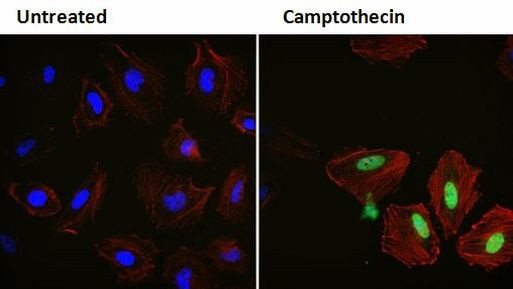 p21 Antibody in Immunocytochemistry (ICC/IF)