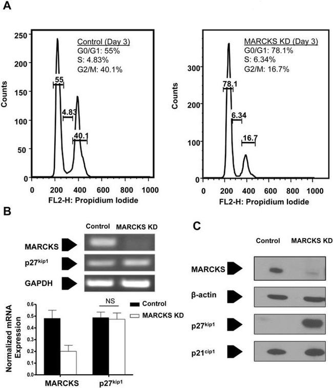 Phospho-p27 Kip1 (Ser10) Antibody in Western Blot (WB)