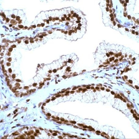 p27 Kip1 Antibody in Immunohistochemistry (Paraffin) (IHC (P))