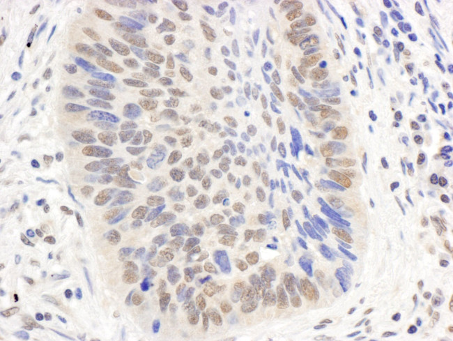 p300 Antibody in Immunohistochemistry (IHC)