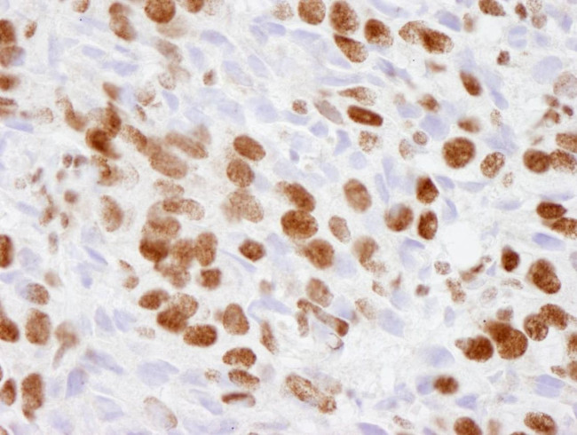 p300 Antibody in Immunohistochemistry (IHC)