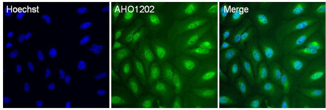 p38 MAPK Antibody in Immunocytochemistry (ICC/IF)