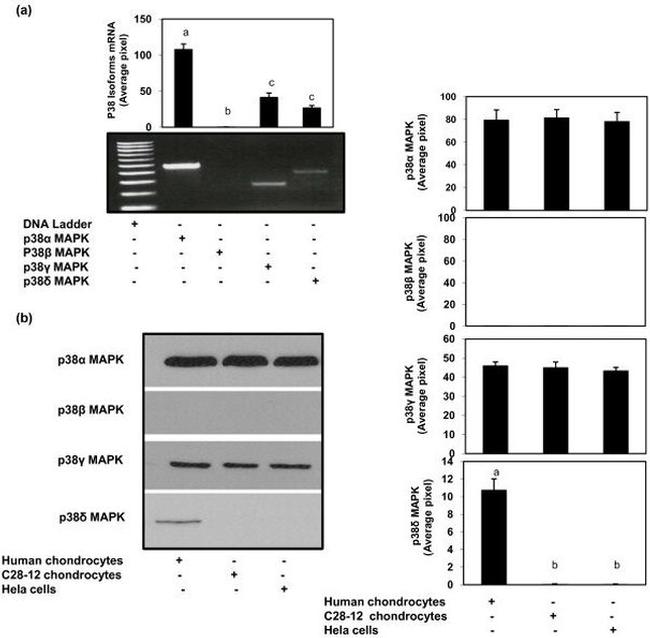 p38 MAPK beta Antibody in Western Blot (WB)