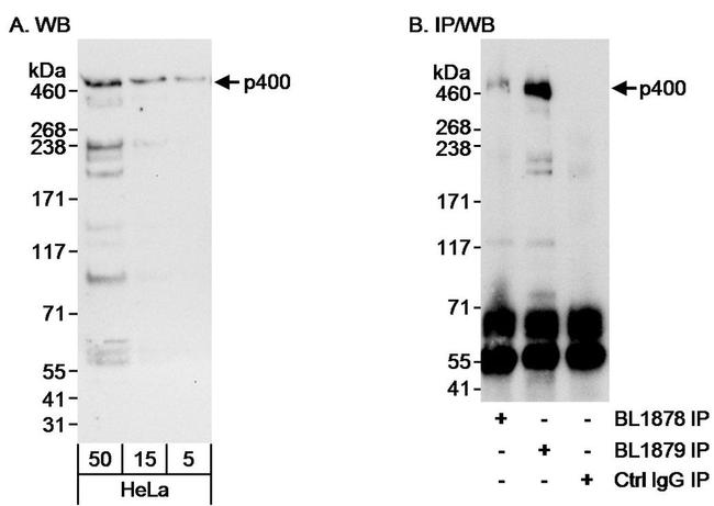 p400 Antibody in Western Blot (WB)