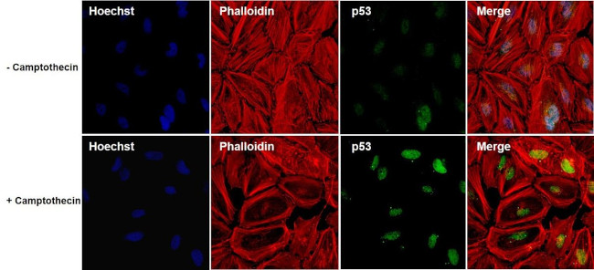 p53 Antibody in Immunocytochemistry (ICC/IF)