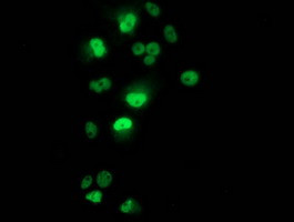 p53 Antibody in Immunocytochemistry (ICC/IF)