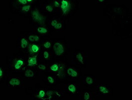 p53 Antibody in Immunocytochemistry (ICC/IF)