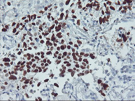 p53 Antibody in Immunohistochemistry (Paraffin) (IHC (P))