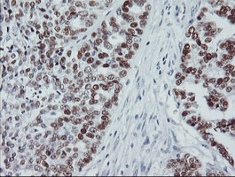 p53 Antibody in Immunohistochemistry (Paraffin) (IHC (P))