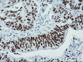 p53 Antibody in Immunohistochemistry (Paraffin) (IHC (P))