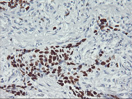 p53 Antibody in Immunohistochemistry (Paraffin) (IHC (P))