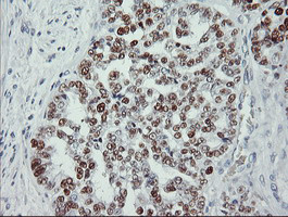 p53 Antibody in Immunohistochemistry (Paraffin) (IHC (P))