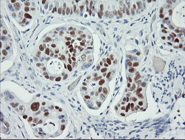 p53 Antibody in Immunohistochemistry (Paraffin) (IHC (P))