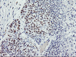 p53 Antibody in Immunohistochemistry (Paraffin) (IHC (P))